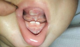 吃梨瓜舌苔发热,揭秘夏日养生之道